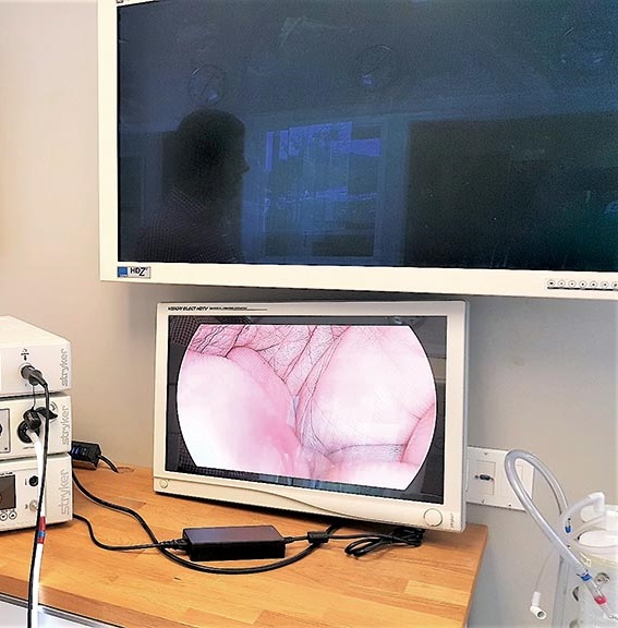 Locação de equipamentos para cirurgias videolaparoscópicas: quais as vantagens?