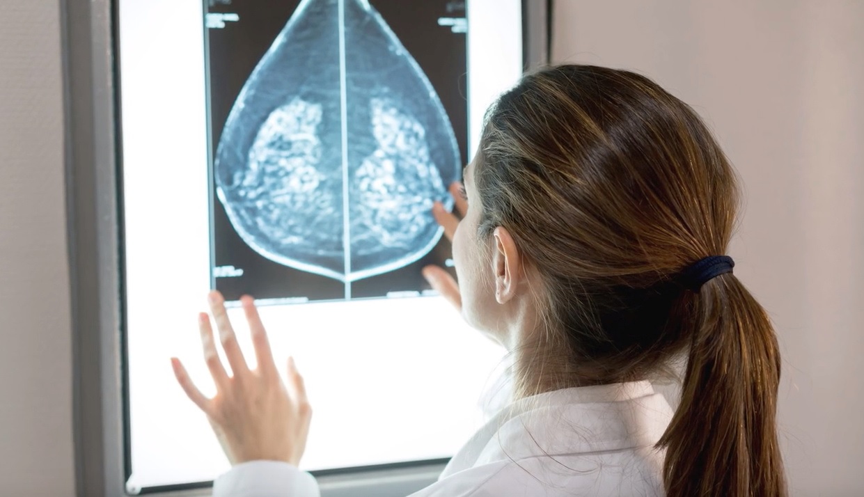 Artigo – Outubro Rosa: Prevenção e diagnóstico precoce do câncer de mama