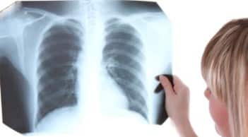 Artigo – Os pacientes de hipertensão pulmonar precisam respirar