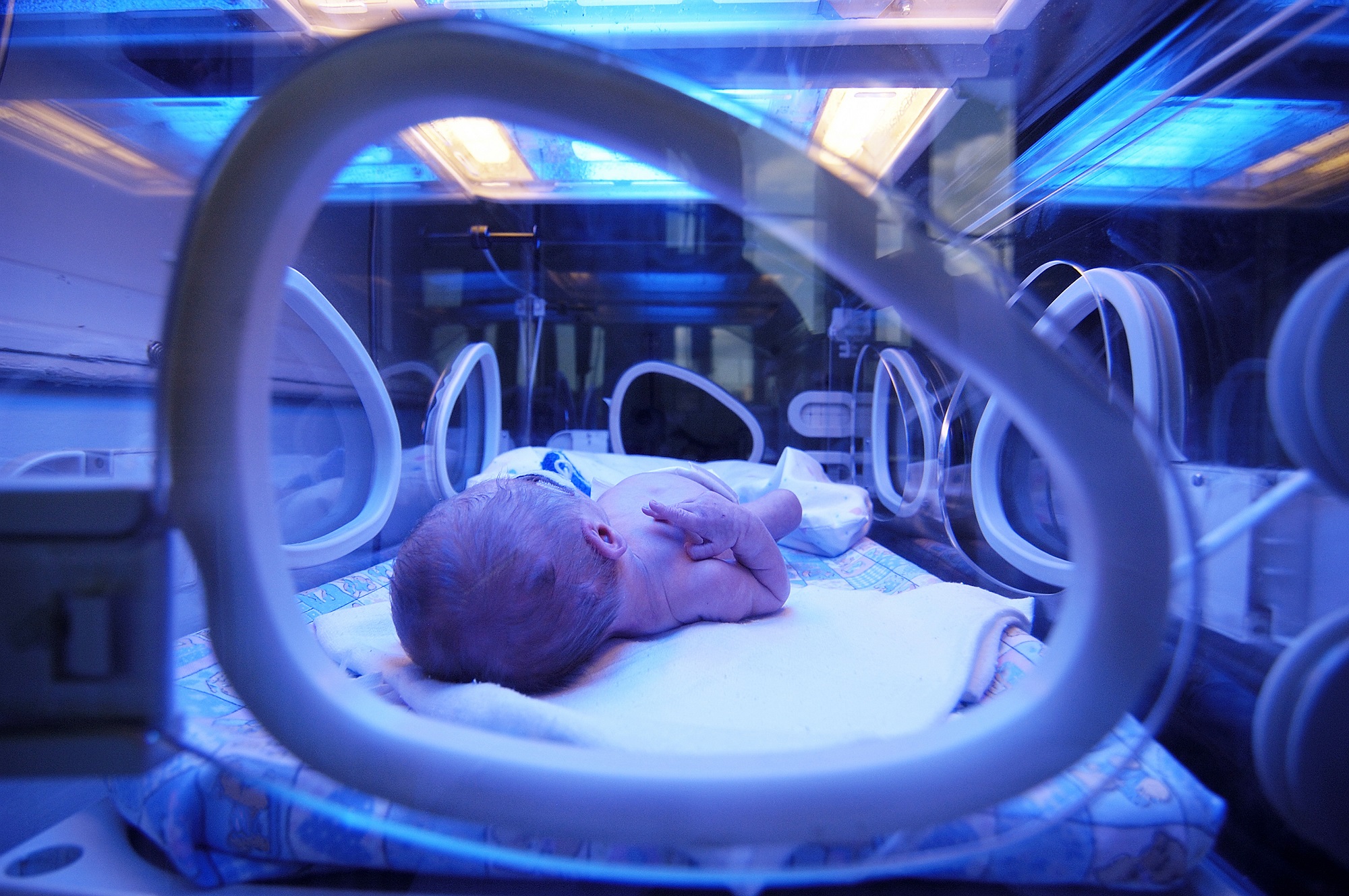 A importância do monitoramento cerebral na UTI neonatal