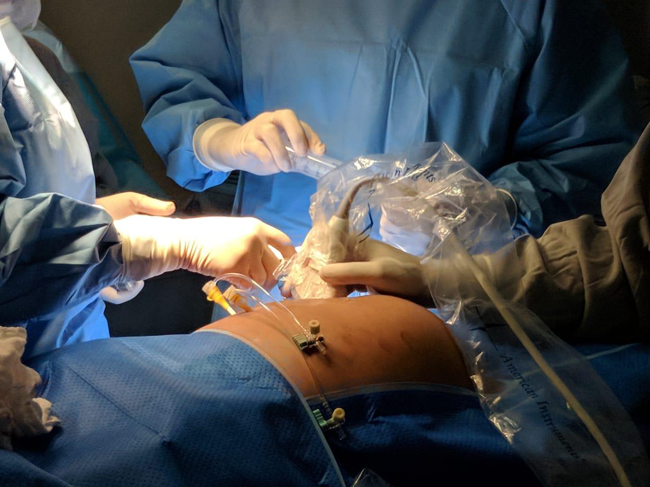 Hospital de Rio Preto realiza procedimento inédito no mundo para corrigir má-formação em feto