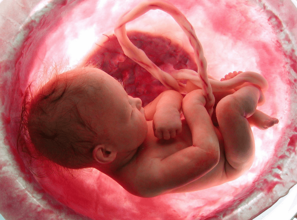 Mater Dei Santa Genoveva realiza procedimento para salvar a vida de feto com anemia